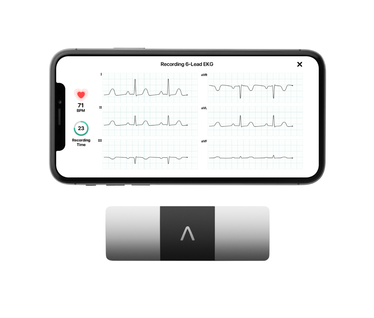 Virtual Clinical Trial cardiac safety technology using 6 lead ECG