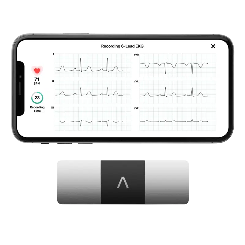 Alivecor KardiaMobile6L device