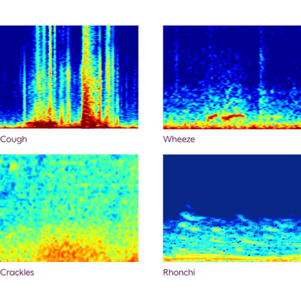 Cough and Lung Sounds Clario