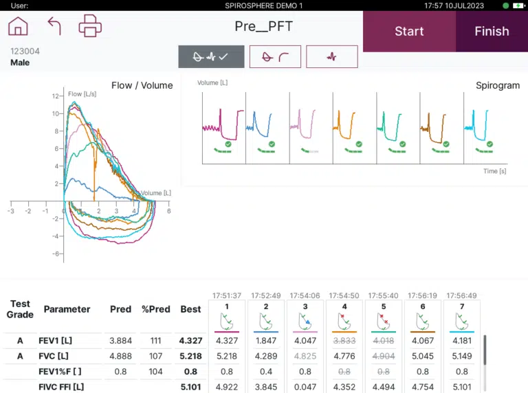 SiteBased Spirometry (FEV1, FVC, PEF, etc.) Clario